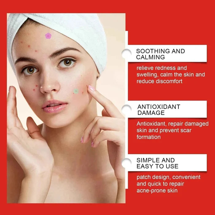 Transform Your Skin Overnight with Invisible Hydrocolloid Acne Patches
